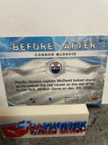 Connor McDavid Oilers 2021-22 Upper Deck MVP Before & After #BA-2